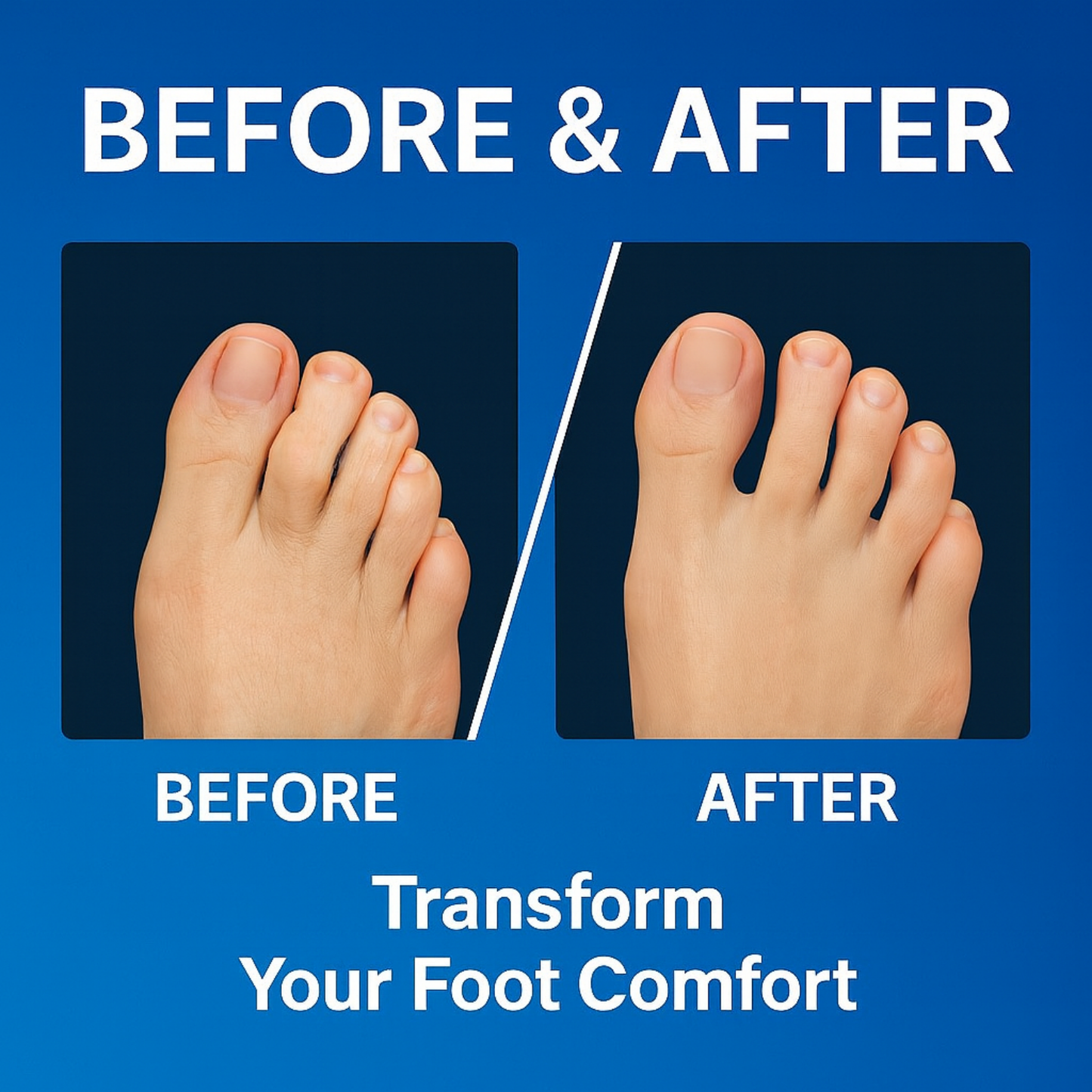 OALUXX Premium Gel Toe Spacers – Washable, Reusable Foot Separators for Daily Comfort – Available in 2pcs or 4pcs, Multiple Colors