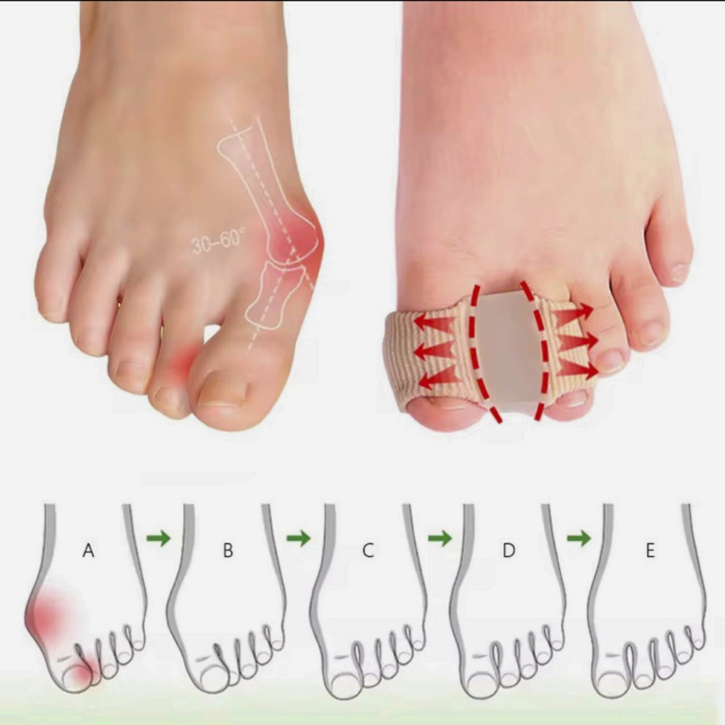 4PCS Toe Separators for Overlapping Toes, Gel Toe Spacers for Feet with two loops